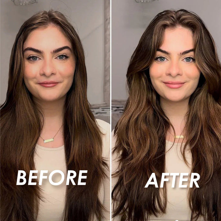 Epitight Dry Shampoo ( BUY 1 GET 1 FREE )