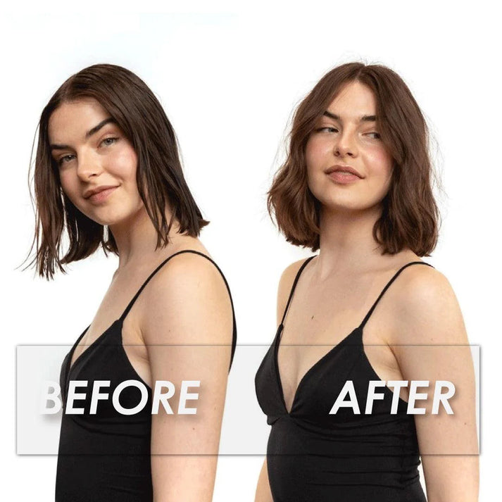 Epitight Dry Shampoo ( BUY 1 GET 1 FREE )